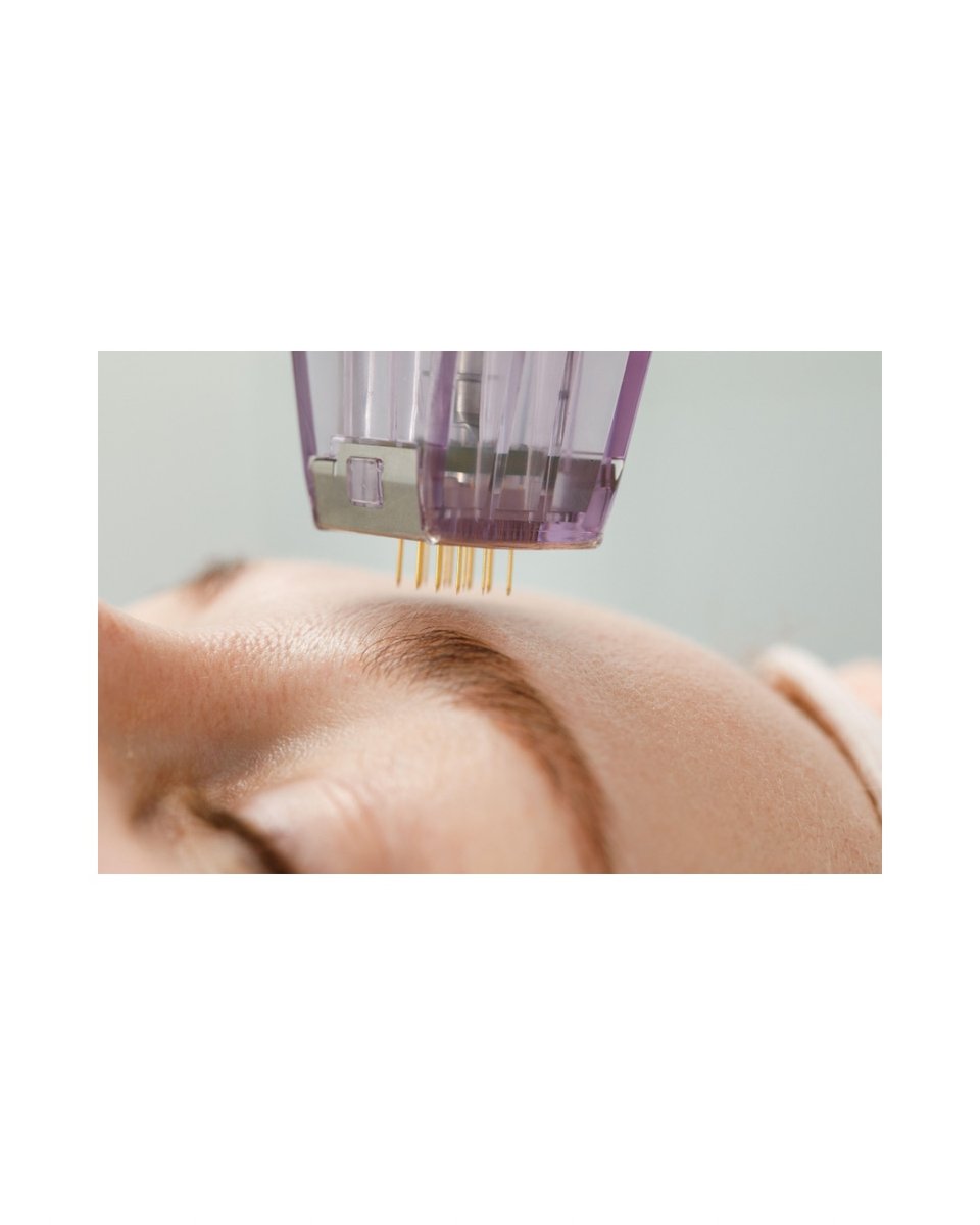 Mesotherapy micro-needling device